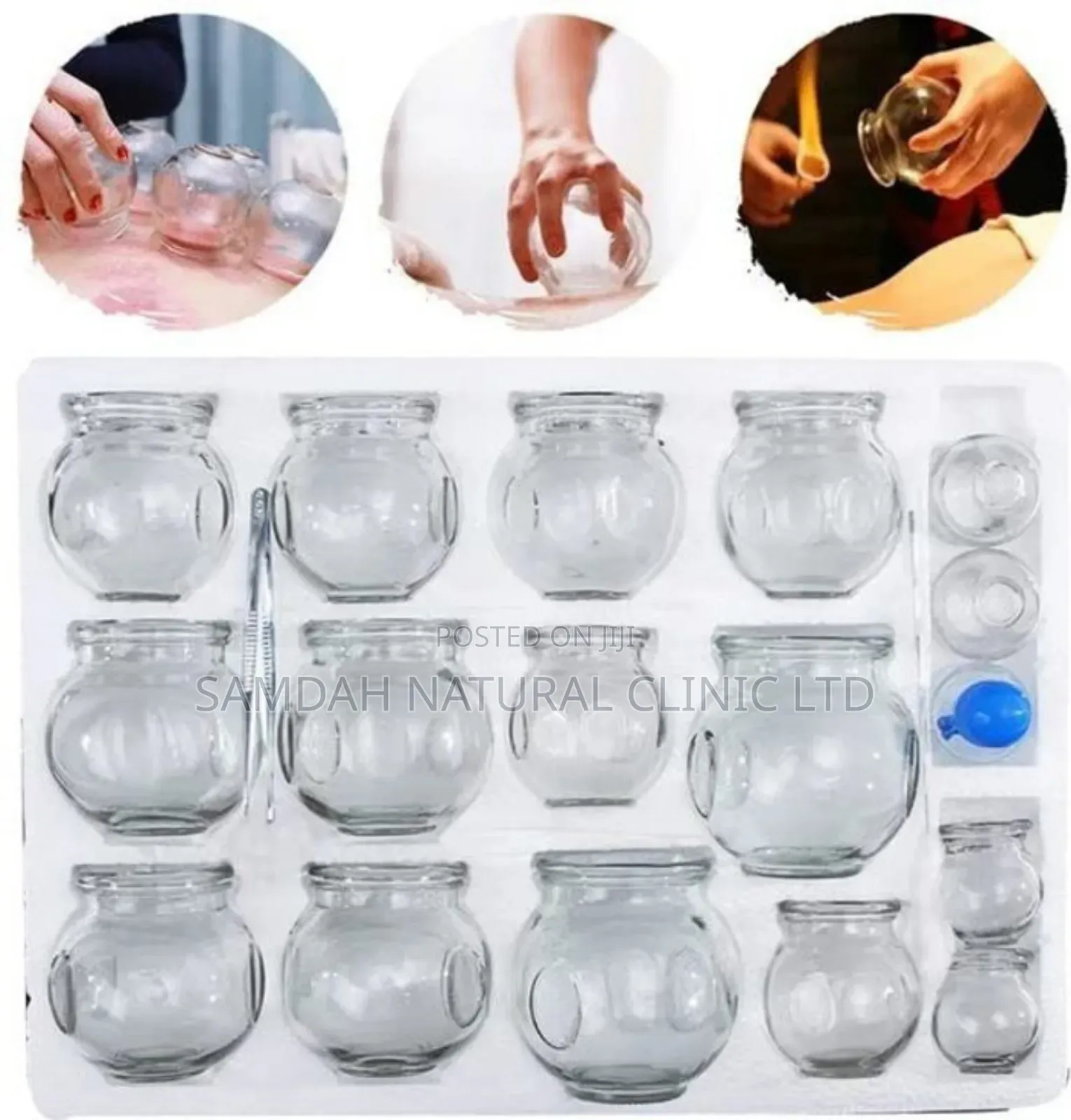 Glass Cupping Set