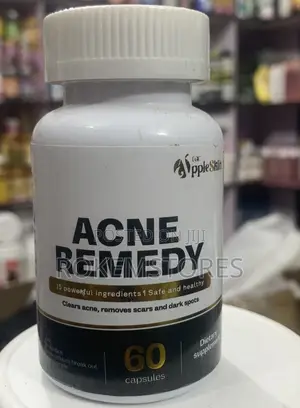 Acne Remedy