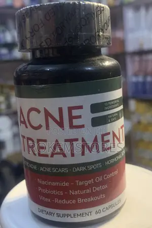 Acne Treatment