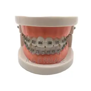 Oral Teeth Braces Drcorative Chain