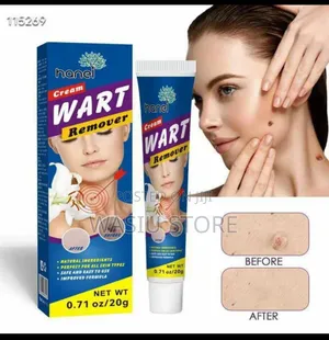 Skin Tag Removal Cream