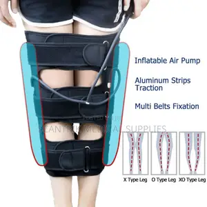 Salon Orthotics Bow Leg and Knocked Knee Brace for Adults in Nigeria