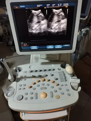 4d Philips Hd9 Ultrasound Machine