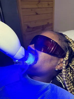 Laser Teeth Whitening and Scaling and Polishing