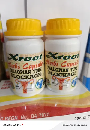 Fallopian Tube Blockage Herbal Capsule