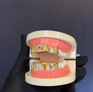 Gold Teeth Grillz – Custom Fit Stylish Design
