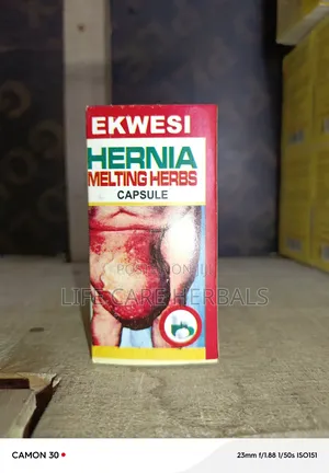 Hernia Melting Herbal Capsule Ekwesi