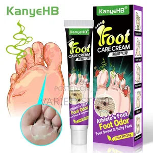 Foot Fungus Removal Cream Remove Beriberi