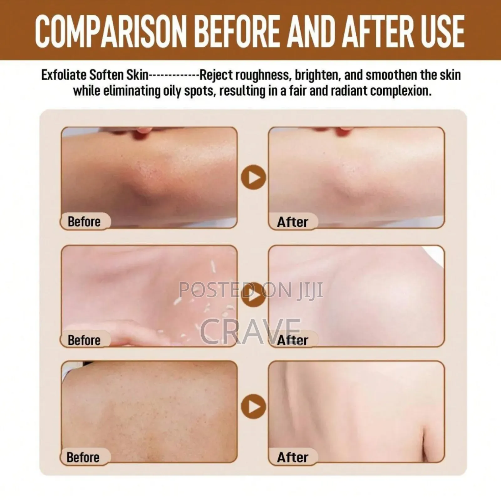 Bha Exfoliating Gel