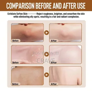 Bha Exfoliating Gel