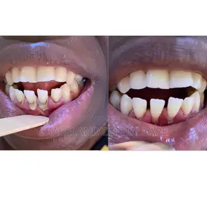 Dental Clinic in Lagos(Abule Egba/Meiran/Kola/Alagbado/Ayobo-Ipaja)