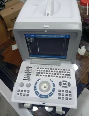 Table Top Ultrasound Machine
