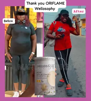 Weight Loss