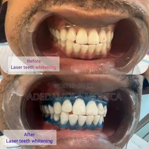 Mobile Dental Care