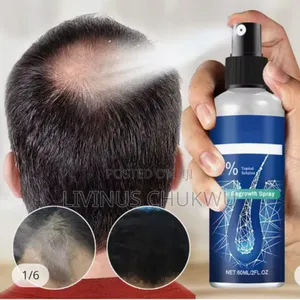 Effective Hair Growth With 6% Minoxidil for Both Men and Women