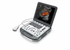Portable Digital Ultrasound System - Dp 10