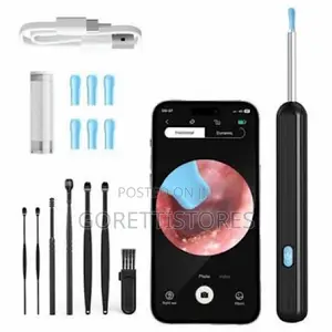 Earwax Removal Tool/Visual Ear Forceps With Bluetooth Camera