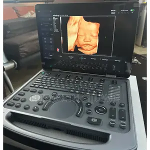 Mindray Mx3 Ultrasound Machine