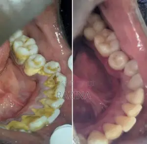 Private Dental Therapist