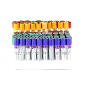 Laboratory Serum Preparation Tube (Non-Vacuum)