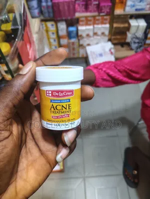 De La Cruz Acne Treatment