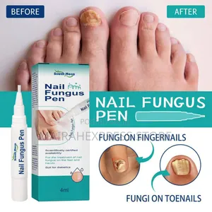 Southmoon Nail Fungus Pen (Cream) - Scientifically Certified Treatment