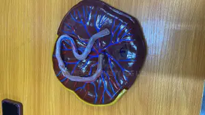 Placenta Model