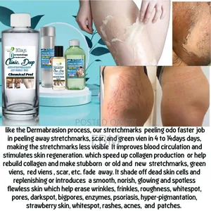 Stretchmarks Nonsurgical Dermabrasion Chemical Peel Set