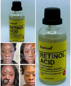 Retino Acid Peel 20% for Wrinks and Fine Lines