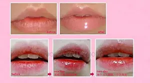 Lip Balm Moisturizer