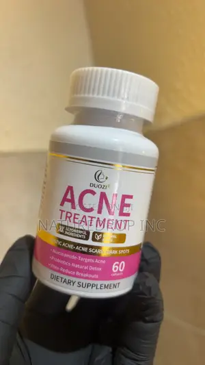 Acne Treatment by Douzi