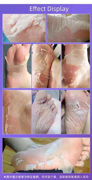 Peeling, Exfoliating Foot Mask