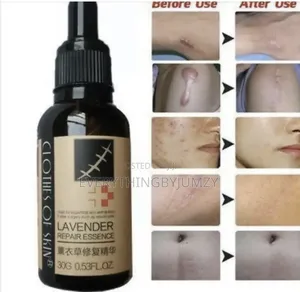 Lavender Repair Essence Oil