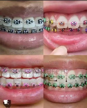Fashion Bracelet
