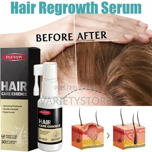 Hair Regrowth Spray