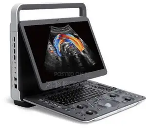 Sonoscape E2 Portable Ultrasound Machine