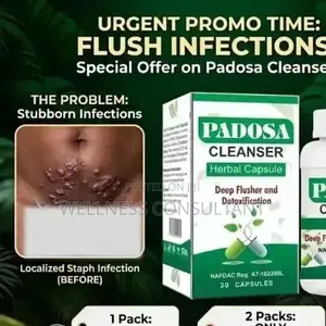 Padosa Herbal Capsule (For Infection)