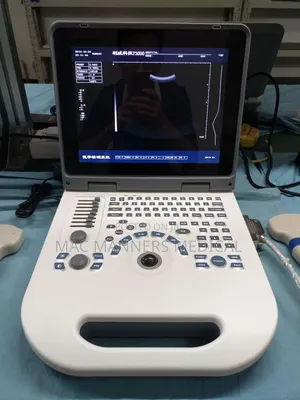 Laptop Ultrasound Scanner Machine