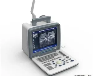Ultrasound Scanning Machine