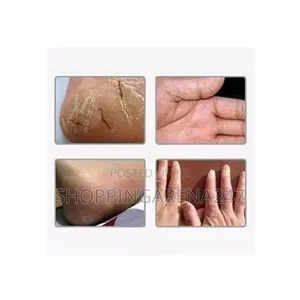 Heel Tastic Intensive Cracked Heel Feet Balm