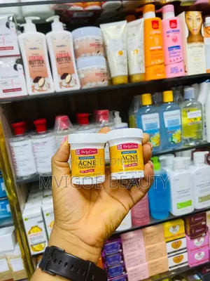 Acne Treatment