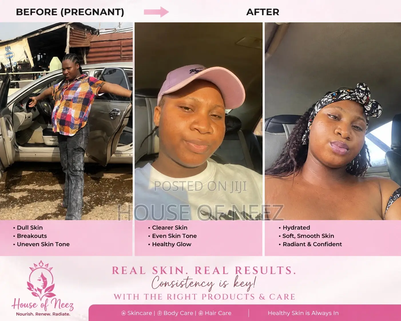 Skincare Solutions
