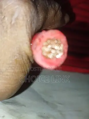 Flexible Cable