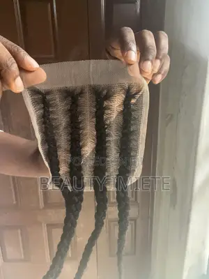 Ventilated Closures