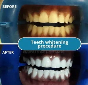 Dental Services
