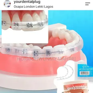 Braces Lip Cover