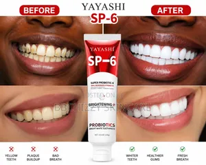 Yayashi Sp-6 Toothpaste