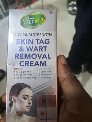 Skin Tag and Wart Removal Cream