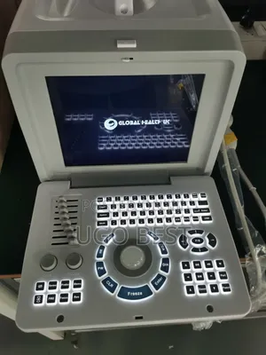 Ultrasound Scanning Machine Table Top