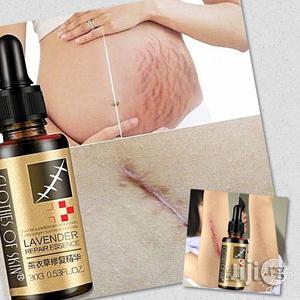 Wicked Scars And Stretch Marks Removal